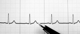 Supraventricular Tachycardia: Diagnosis & Therapy
