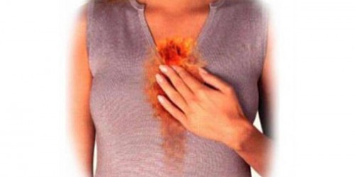 Stress and Heartburn