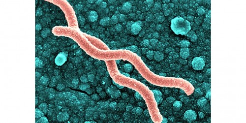 Helicobacter pylori associated diseases