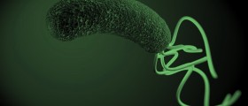 Helicobacter Pylori, From Its Discovery To Its Role In Cancer