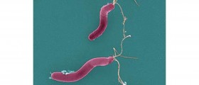 Helicobacter: The Bacteria that Cause Ulcers