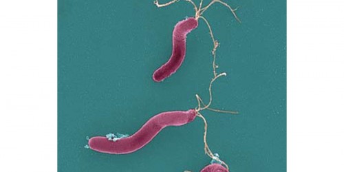 Helicobacter: The Bacteria that Cause Ulcers