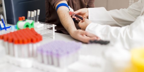 Hepatitis C Overview: Symptoms, Diagnosis, And Treatment