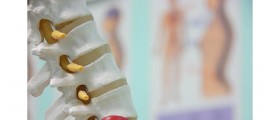 Corrective Exercises For Herniated Disc