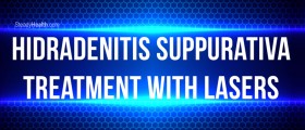Hidradenitis Suppurativa Treatment With Lasers: A Newer Approach To Treating HS Pain And Breakouts