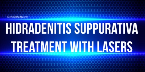 Hidradenitis Suppurativa Treatment With Lasers: A Newer Approach To Treating HS Pain And Breakouts