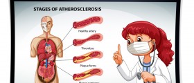 How Can High Cholesterol Lead to Atherosclerosis?