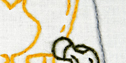 Hip Bursitis - Trochanteric Bursitis