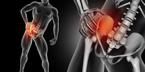 Pain Relief | How to Effectively Avoid Hip Pain