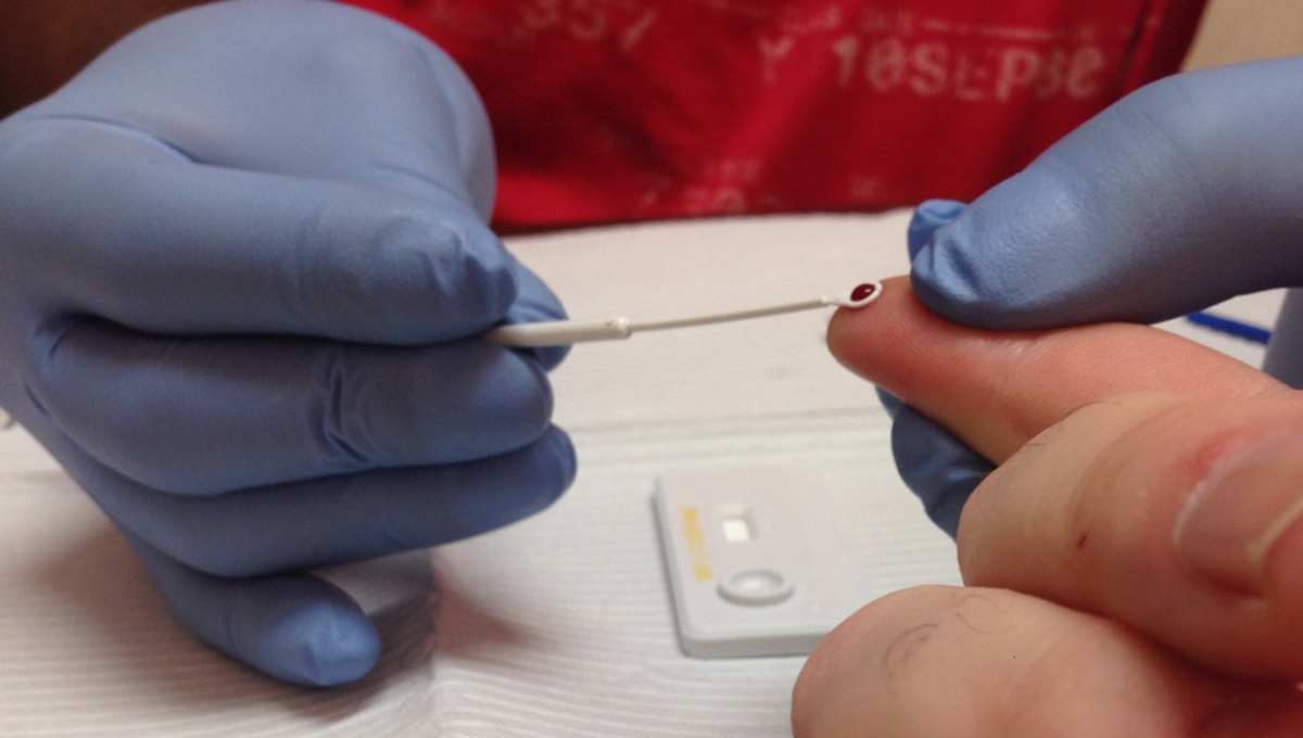 New HIV Testing Methods Offer Faster Treatment | Autoimmune diseases articles | Body & Health ...