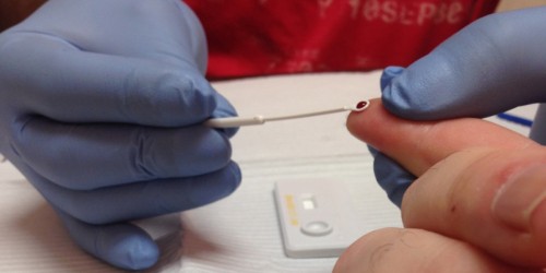 New HIV Testing Methods Offer Faster Treatment