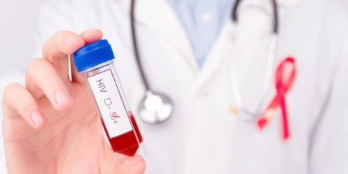 HIV Testing Day: You Can't Be Sure You're Not Positive Unless You Actually Get Tested