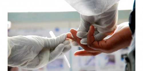 Sixty-Second HIV Testing Now Available In The USA