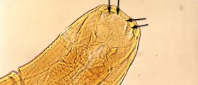 Would You Recognize These Dangerous Parasitic Infestations?