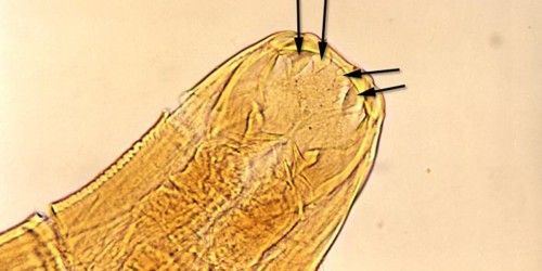 Would You Recognize These Dangerous Parasitic Infestations?