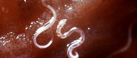 Bloodsucking Parasite Could Make You Healthier