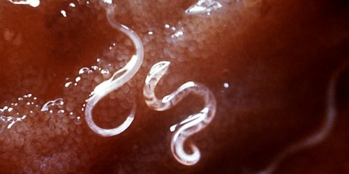 Bloodsucking Parasite Could Make You Healthier