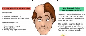 Scientists Find New Hope For Balding Problems