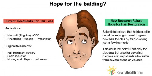 Scientists Find New Hope For Balding Problems