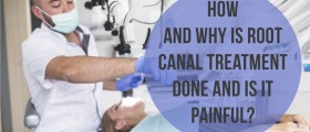 How And Why Is Root Canal Treatment Done And Is It Painful?