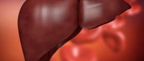 How Can High Cholesterol Impact Your Liver?