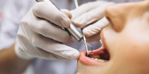 How Long Can A Tooth Survive After A Root Canal Treatment?