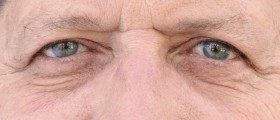 How To Deal With Emotions In Dementia: 5 Common Changes In Emotional Behavior