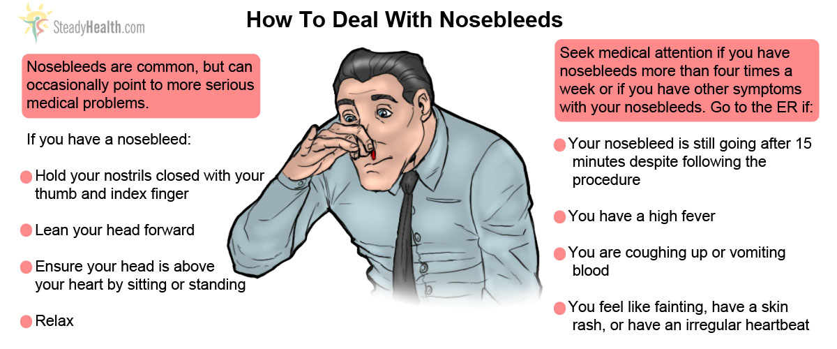 nosebleeds-when-to-be-worried-ear-nose-throat-and-dental-problems