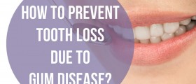 How To Prevent Tooth Loss Due To Gum Disease?