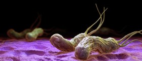 Helicobacter pylori: The Bacteria that Cause Ulcers