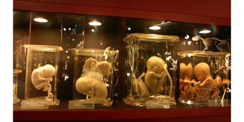 Amniotic Fluid: A New Way To Save Diabetic Feet