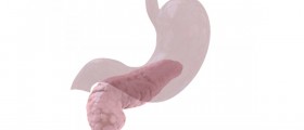 Pancreatic (Pancreas) Cancer Symptoms and Treatment Alternatives