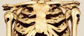 Costochondritis: Symptoms & Treatment