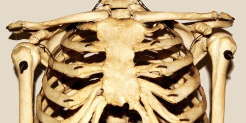 Costochondritis: Symptoms & Treatment