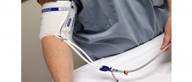 Do Natural Hypertension Treatments Work?