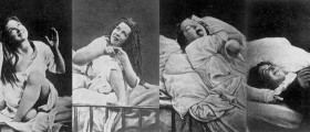 Historical Mental Health Diagnoses You Won't Believe Existed