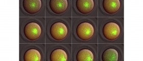 Three-Parent IVF: What, Why, And Why Not