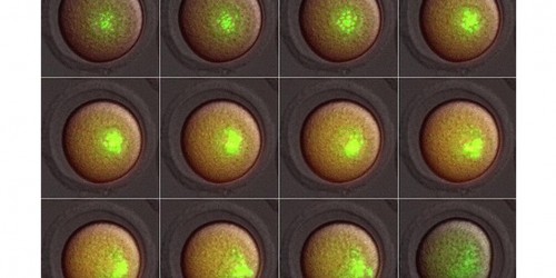 Three-Parent IVF: What, Why, And Why Not