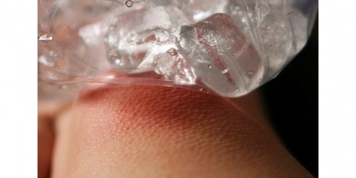 Knee Problems And Cardio Workouts