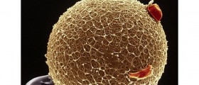 IVF Babies Are 30% More Likely To Have A Birth Defect