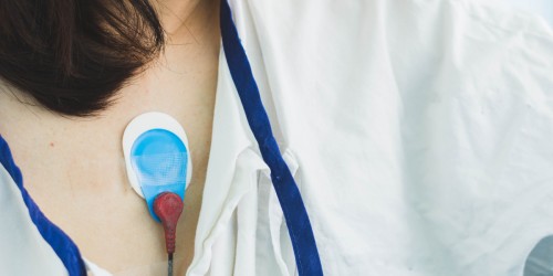 How Is An Irregular Heartbeat Diagnosed? 5 Common Tests For Arrhythmia