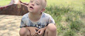 Is There A Connection Between Down Syndrome And Alzheimer's Disease?