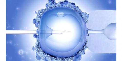 High Doses Of Hormones And Ivf Complications