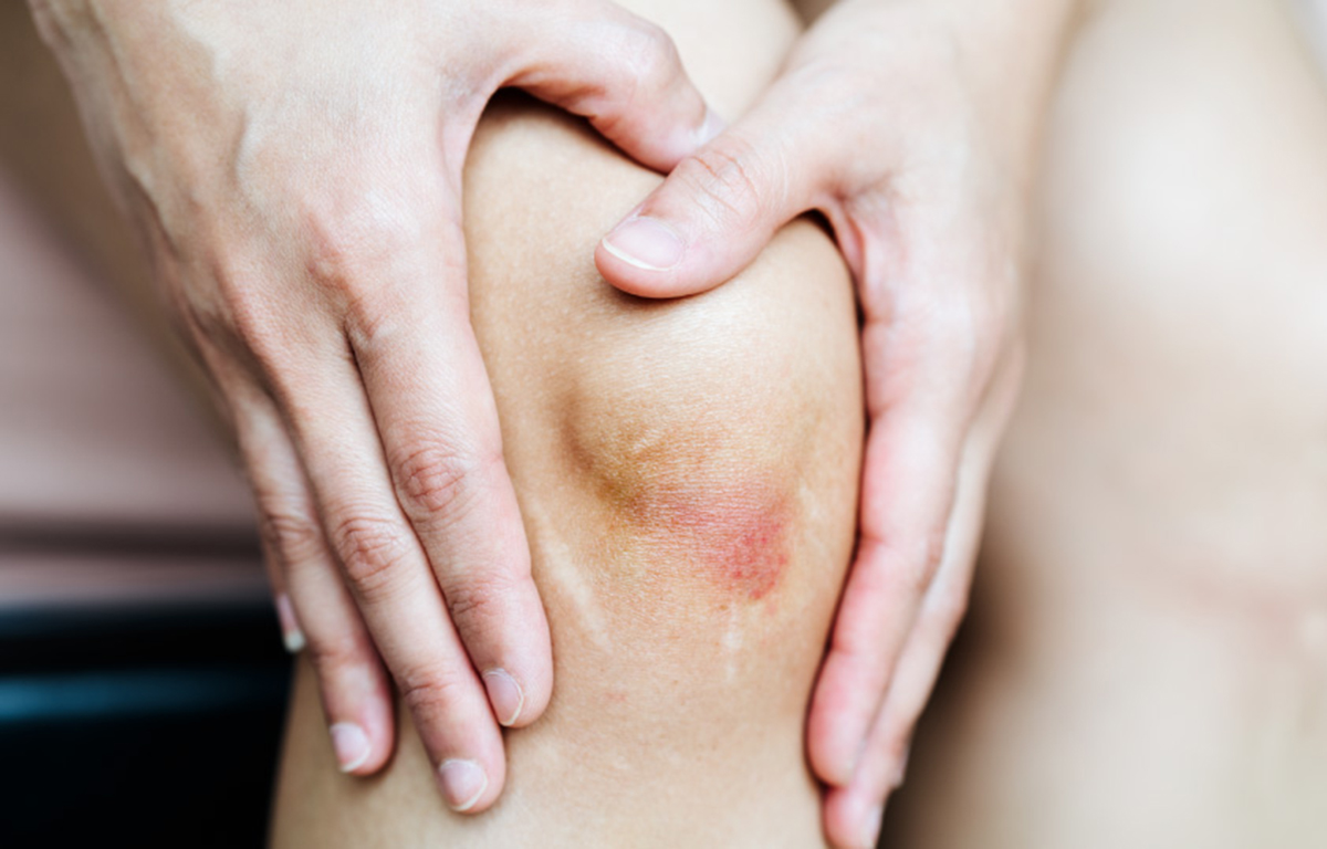 Juvenile Psoriatic Arthritis Overview Causes, Symptoms