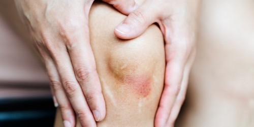 Juvenile Psoriatic Arthritis Overview: Causes, Symptoms, Diagnosis, And Treatment