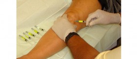 Hyaluronic Acid And Prophylaxis Of Arthritis Complications