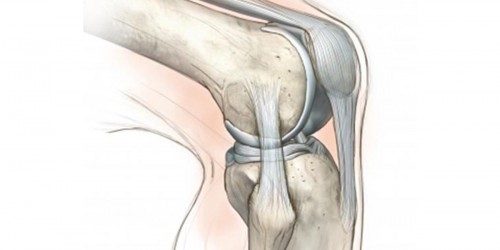 Partial Knee Replacement - Unicompartmental Knee Arthroplasty