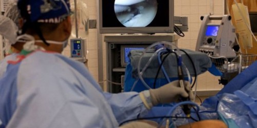 Cholecystectomy - Laparoscopic Surgery for Gallbladder Removal