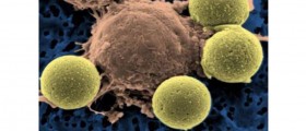 Could A Single Drug Treat Every Kind Of Cancer?