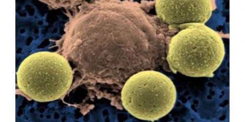 Could A Single Drug Treat Every Kind Of Cancer?